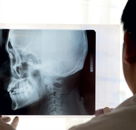 Spotting Salivary Gland Cancer