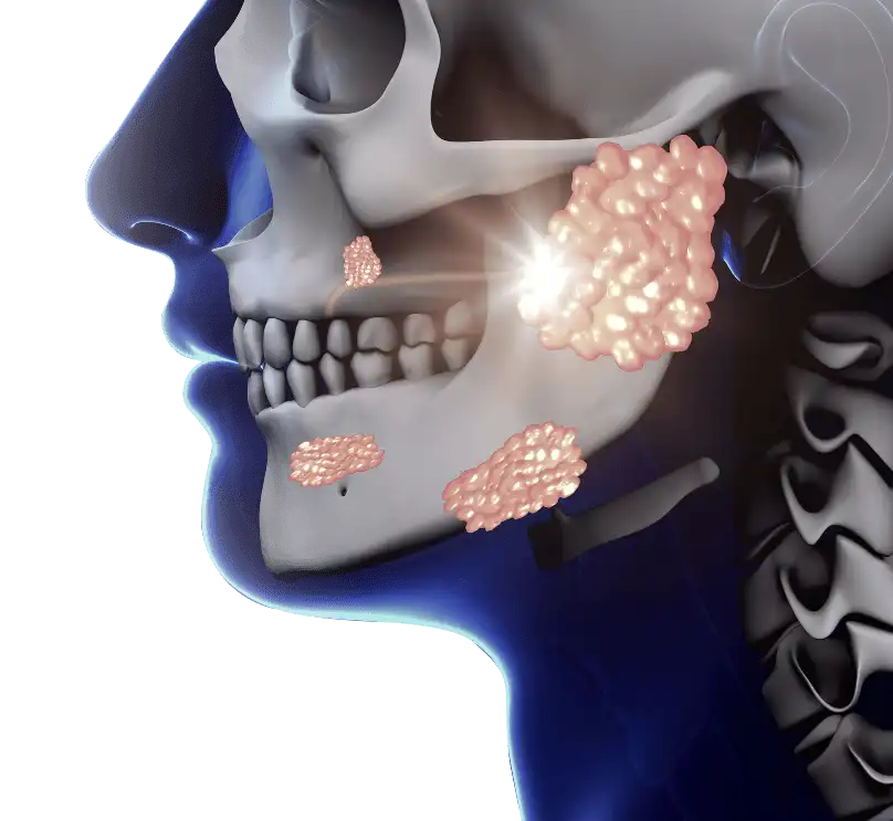 The Parotid Glands